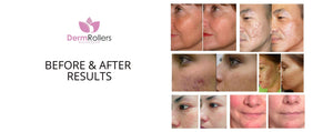Skin-disorders-condition-treatment-before-and-after